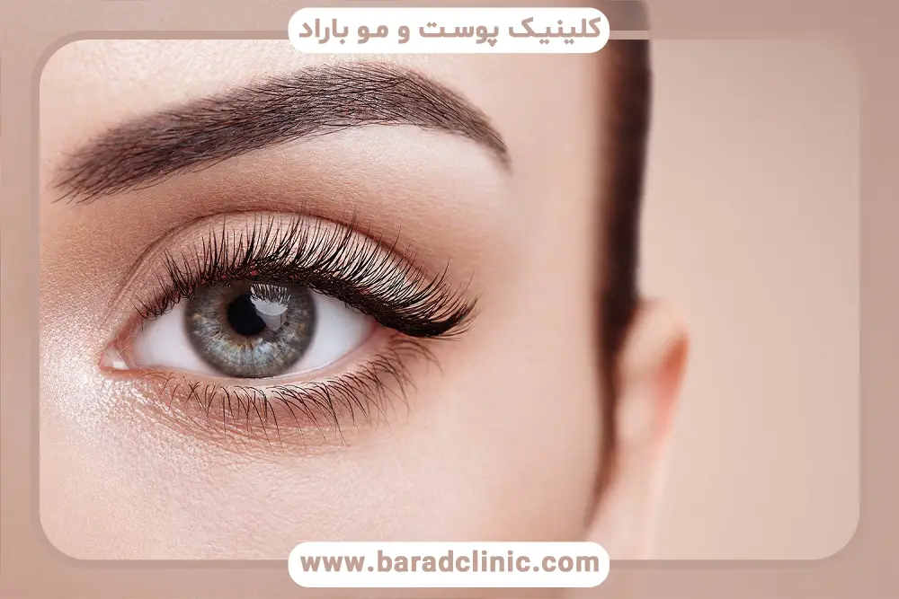 تزریق فیلر جایگزین بلفاروپلاستی