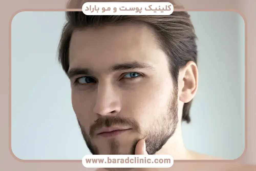 ریسکها و عوارض کاشت ریش با لیزر