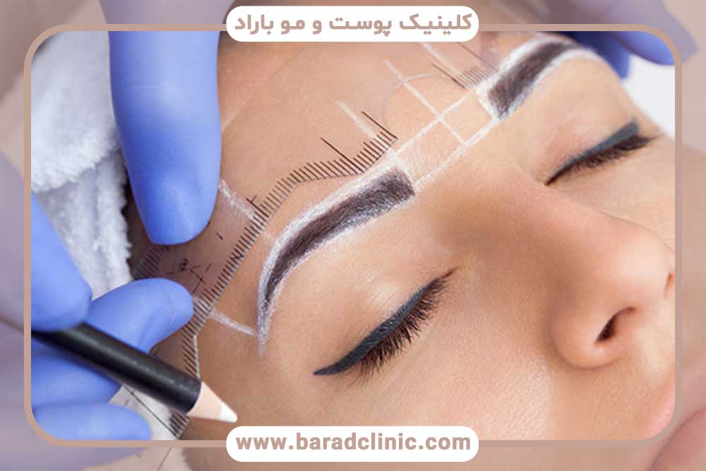 کاشت ابرو بدون برش سر