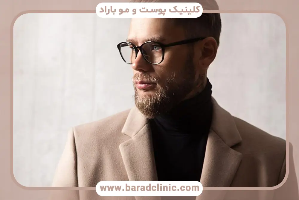 کاشت ریش طبیعی در تهران