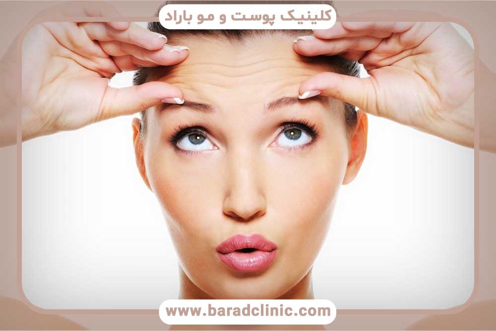 عدم تقارن ابرو بعد از بوتاکس