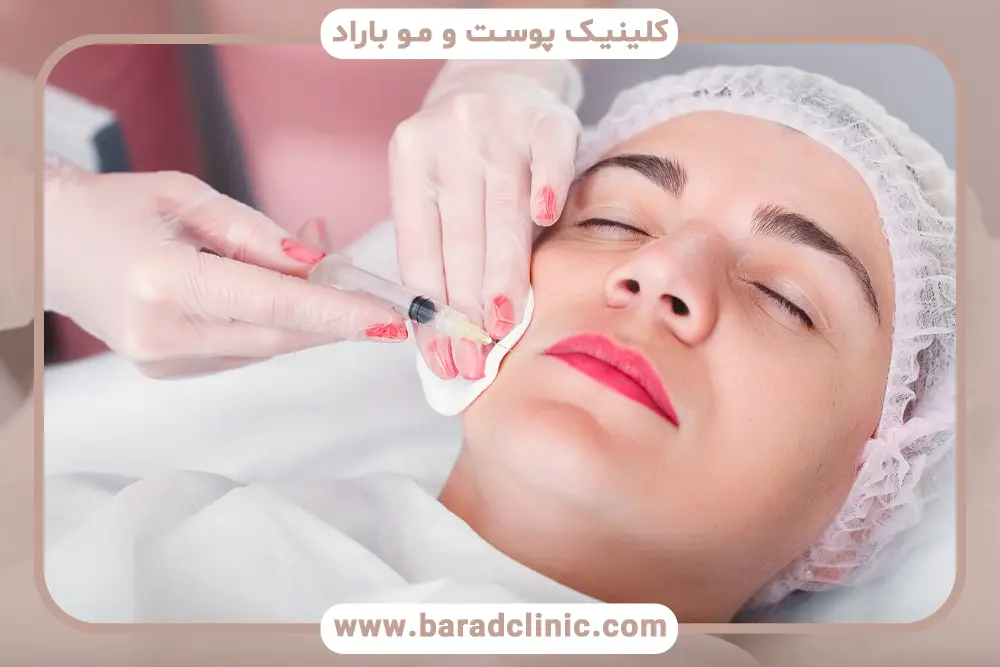 پروسیجر پوست