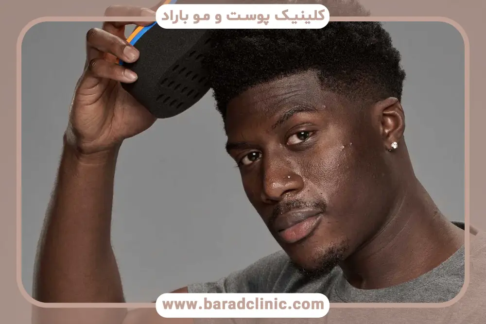 تبلیغات کاشت مو