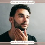 کاربردها و دلایل انجام کاشت ریش و سبیل