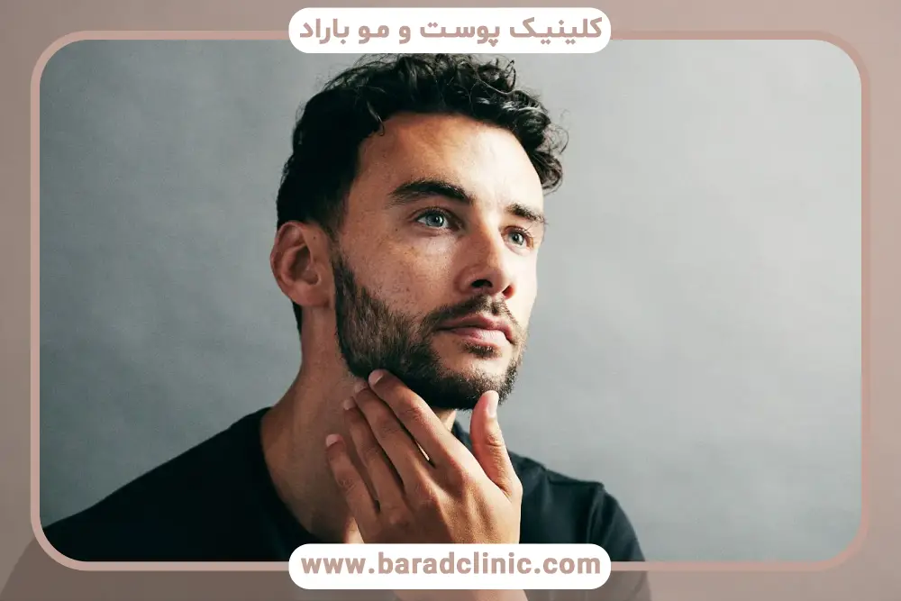 کاربردها و دلایل انجام کاشت ریش و سبیل