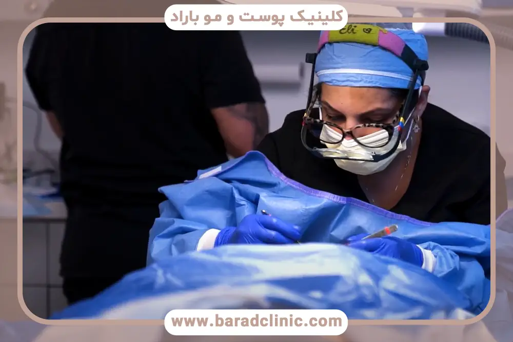 بهترین جراح کاشت ریش در ایران