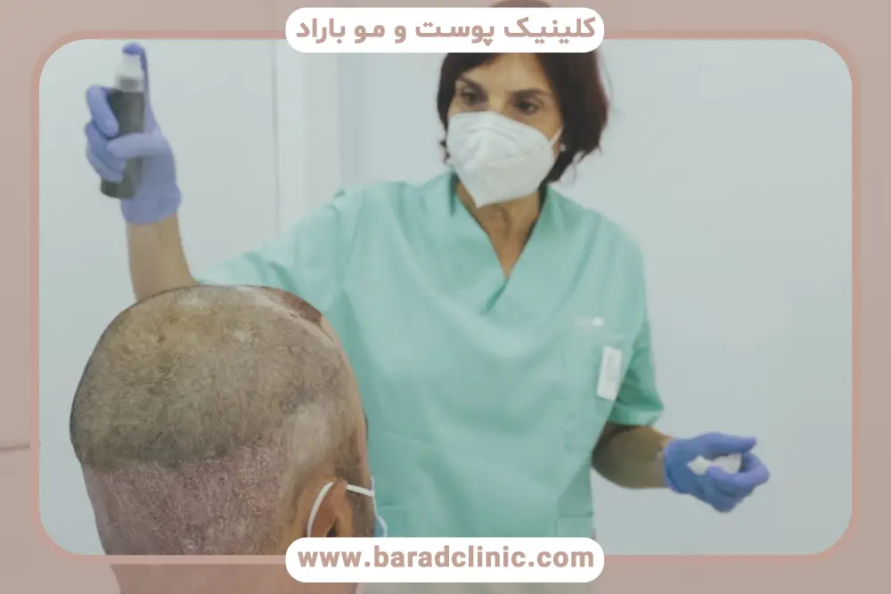 اسپری بعد از کاشت مو