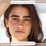 مکمل رشد ابرو