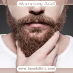 کاشت ریش قیمت