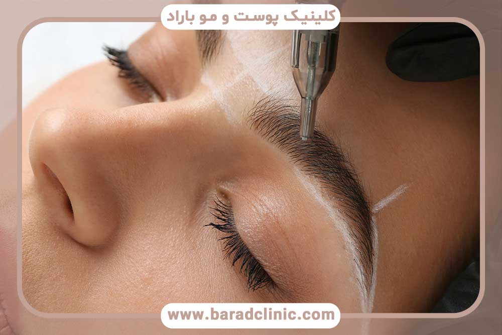 آزمایش‌های ضروری قبل از کاشت ابرو