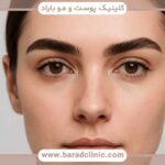 کاشت ابرو حرام است