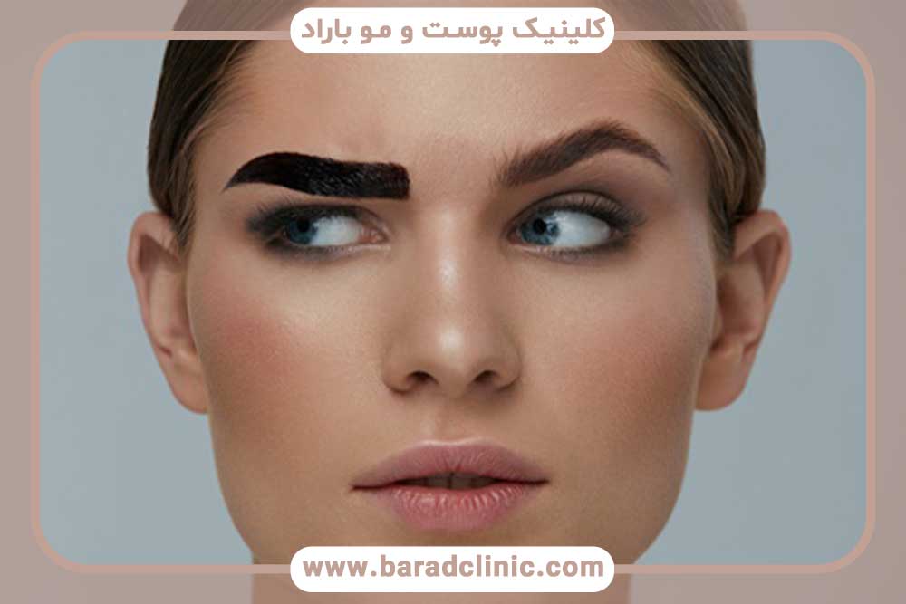 کاشت ابرو بر روی تاتو