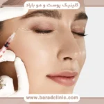 برای مزوتراپی مو کجا برم