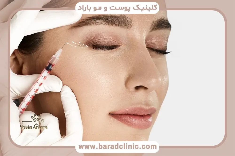 برای مزوتراپی مو کجا برم