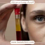 مقایسه prp و prf