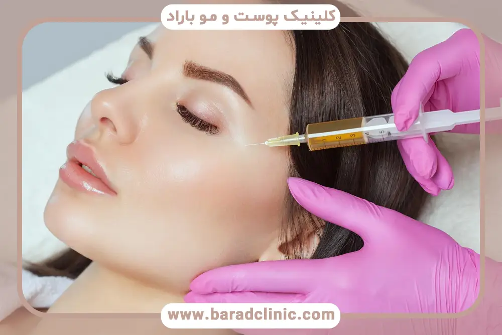 prp به چه معناست