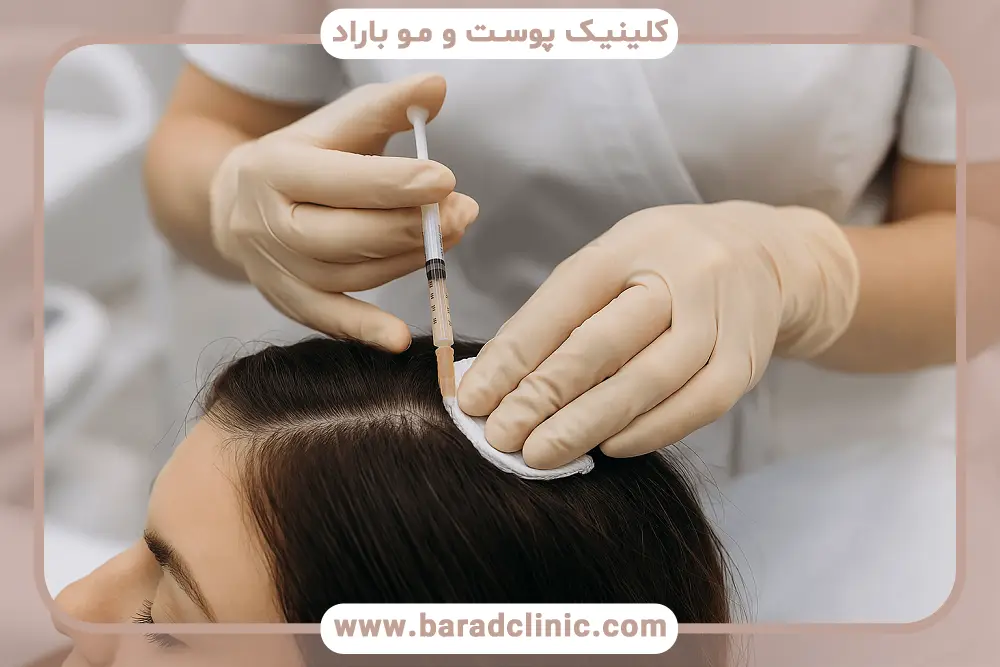 مزوتراپی برای پرپشتی مو