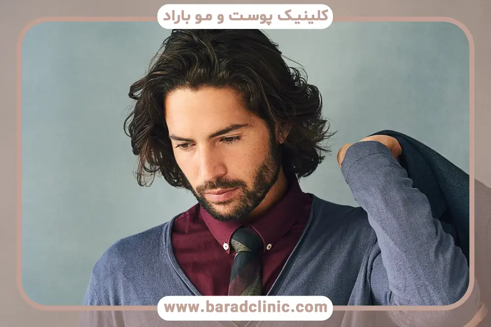 کاشت مو به روش fut