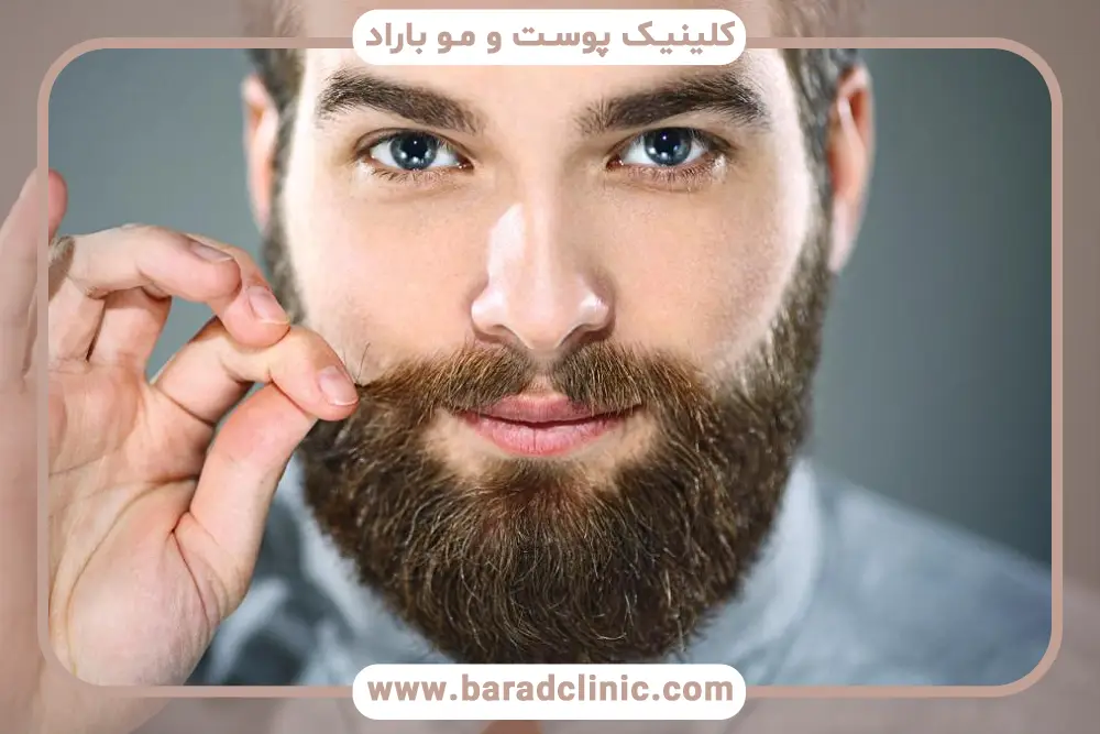 کاشت ریش تضمینی