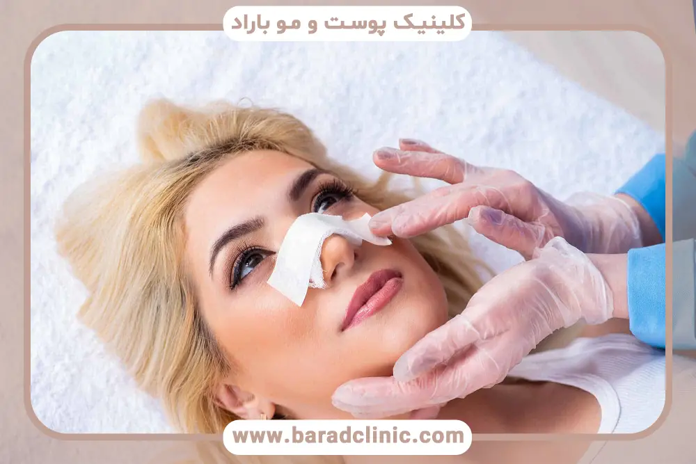 پروسیجر بینی