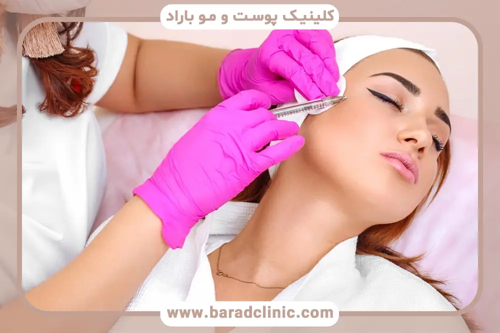 مزوتراپی برای جای جوش