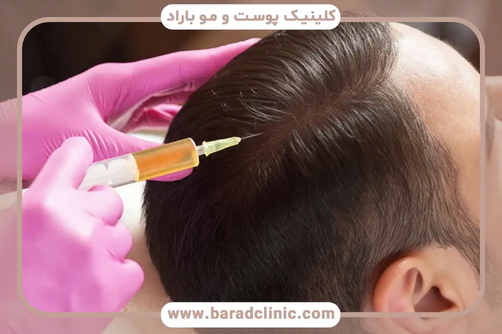 آیا prp موثر است