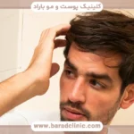 فیلم کاشت مو به روش سلولهای بنیادی