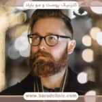 کاشت ریش کامل