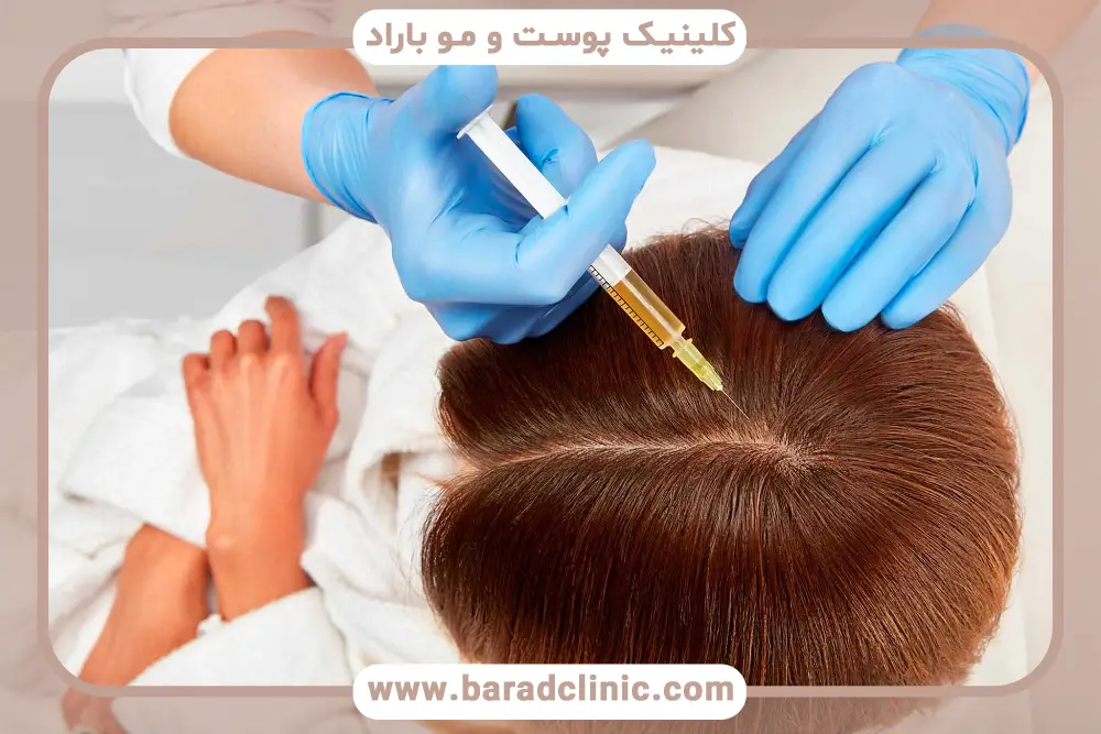 آیا prp عوارض دارد