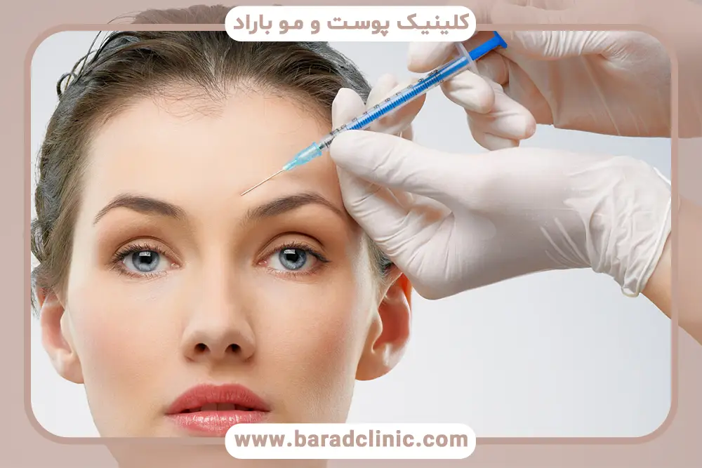 بوتاکس پیشانی