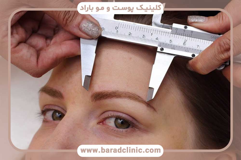 بوتاکس بعد از کاشت ابرو