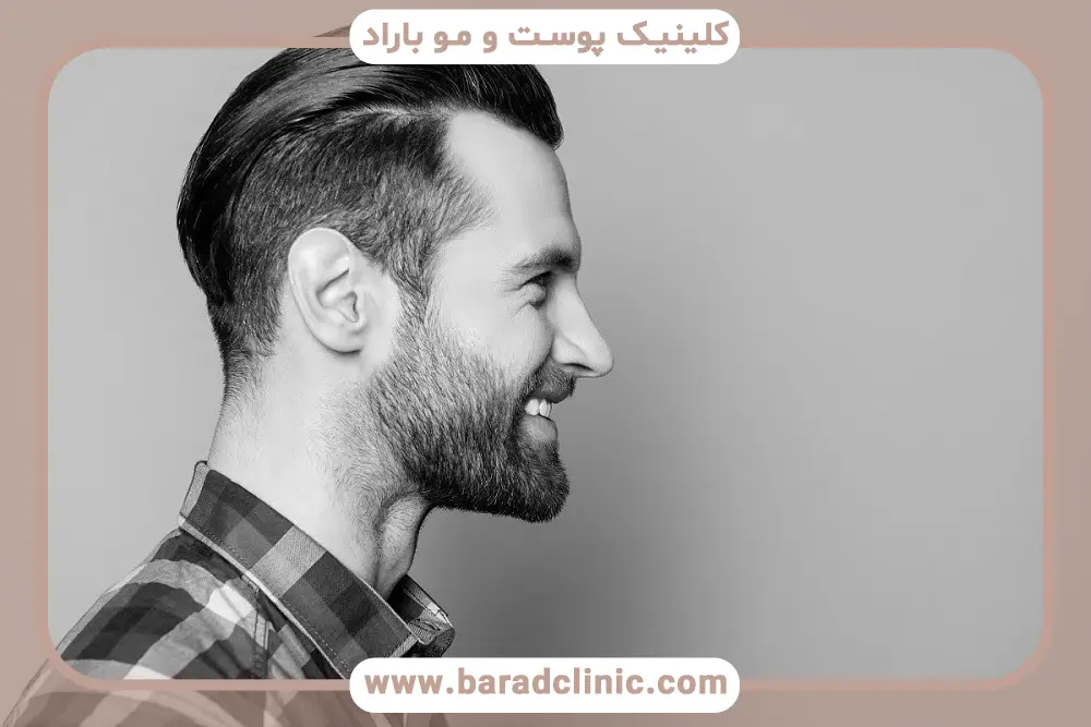 تجربه واقعی مراجعان از کاشت ریش طبیعی در تهران