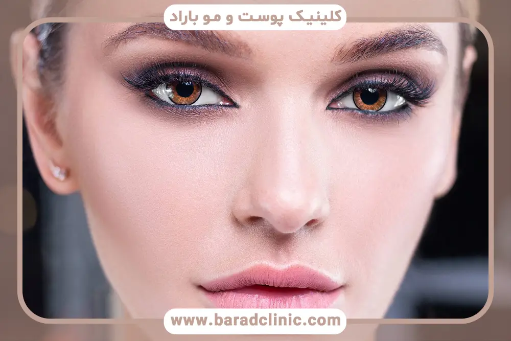 آشنایی با بلفاروپلاستی چشم روباهی