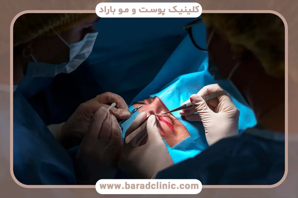 اهمیت مشاهده فیلم عمل بلفاروپلاستی با لیزر