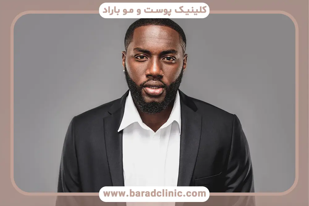 عوامل موثر بر قیمت کاشت ریش