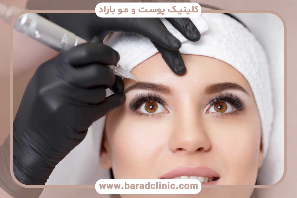 کاشت ابرو بر روی تاتو