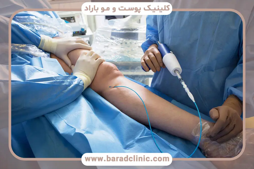 آشنایی با پروسیجر درمانی