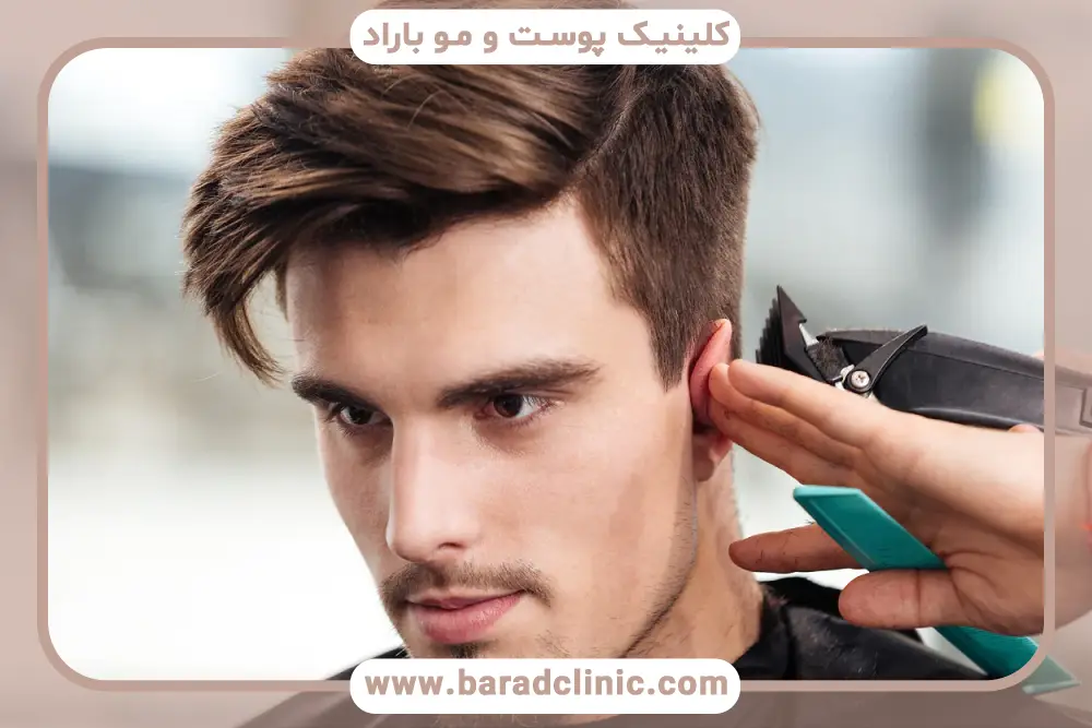 عوامل تعیین کننده هزینه کاشت مو در تهران