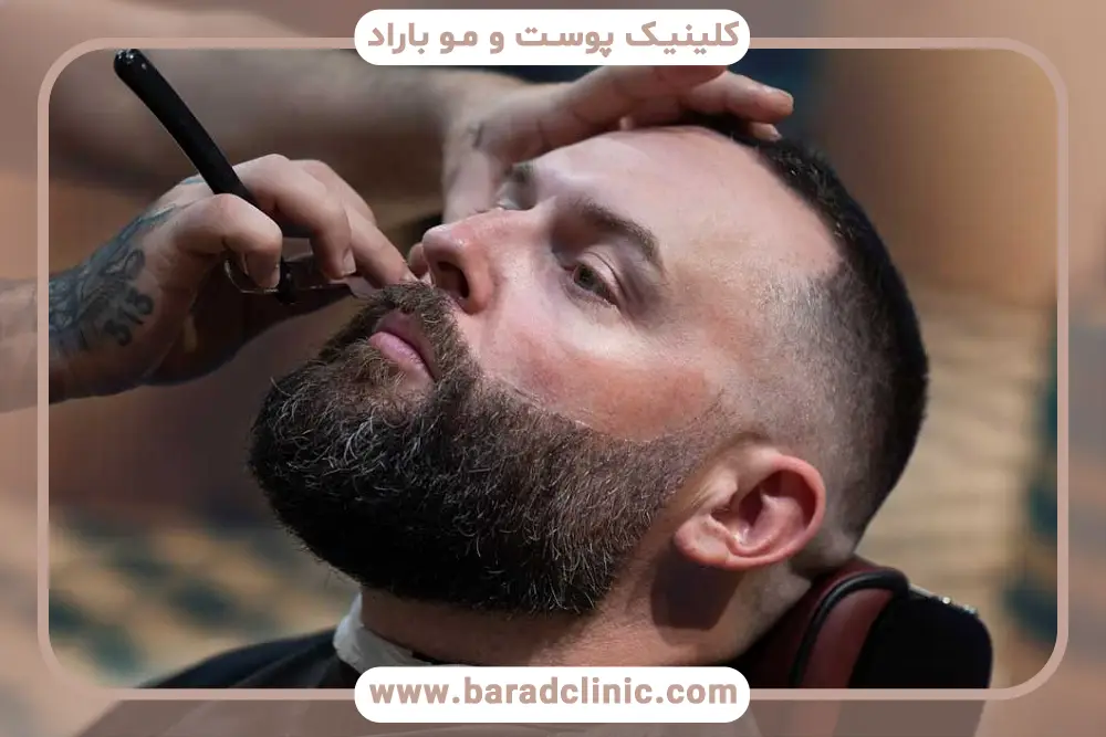 آشنایی با کاشت ریش به روش fit