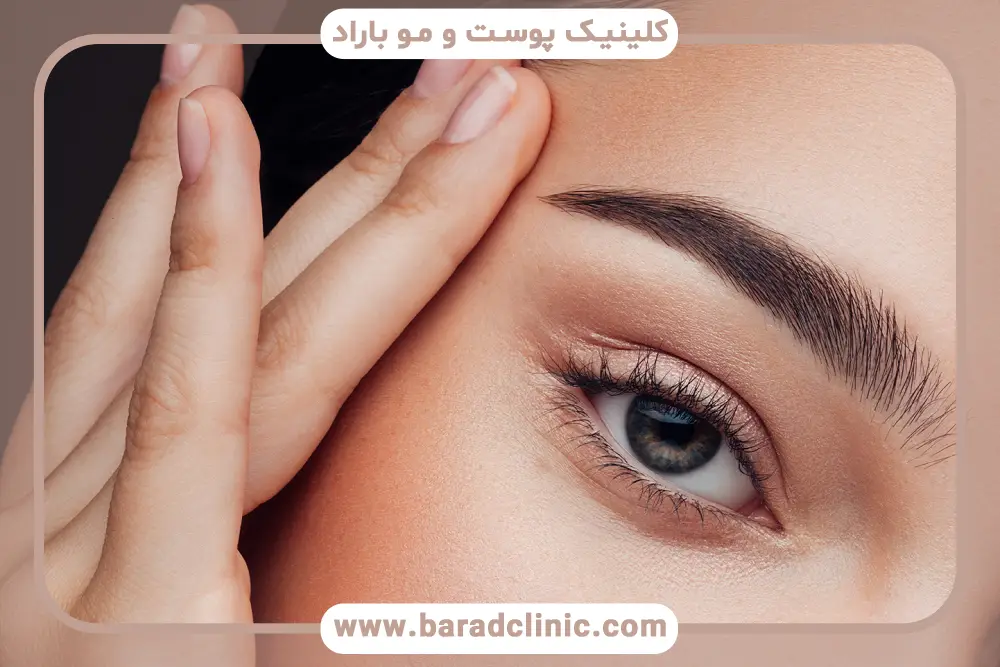 آشنایی با خدمات بلفاروپلاستی بدون بخیه