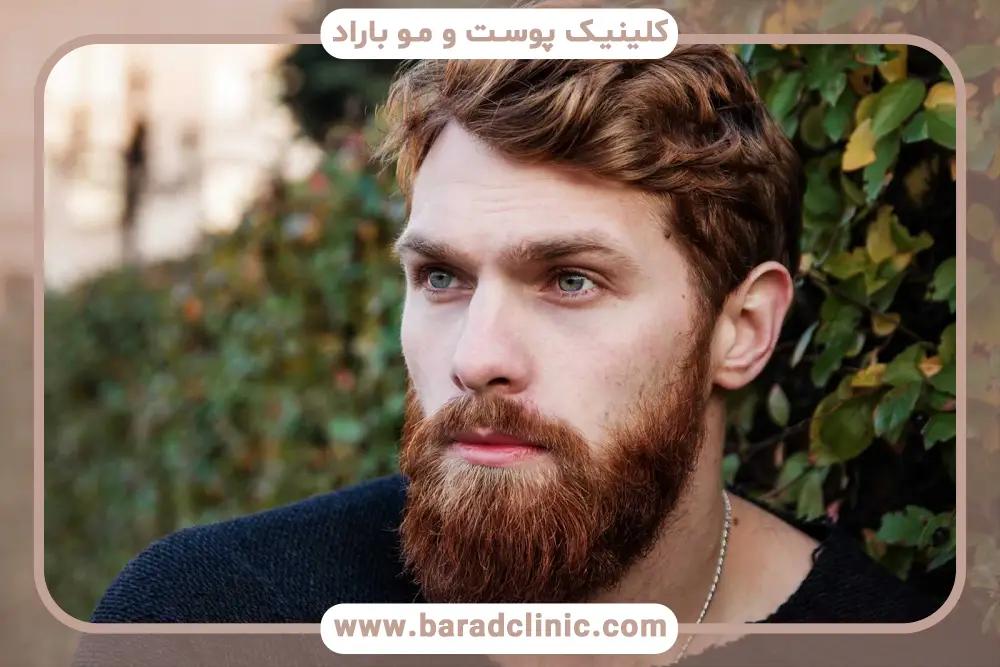 شرایط کاشت ریش