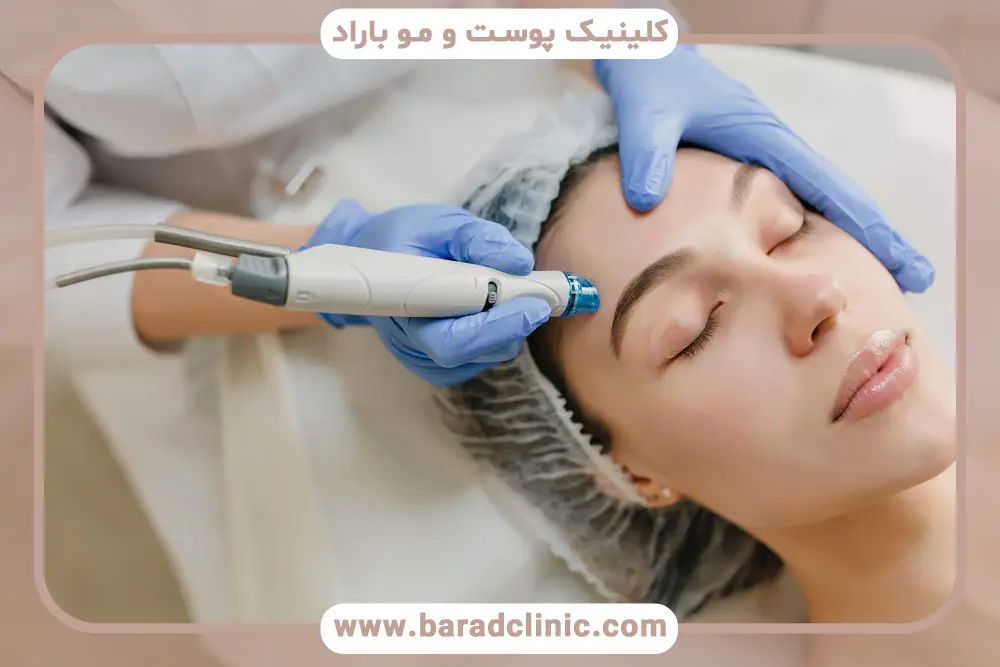 مزایای مزوتراپی برای جای جوش