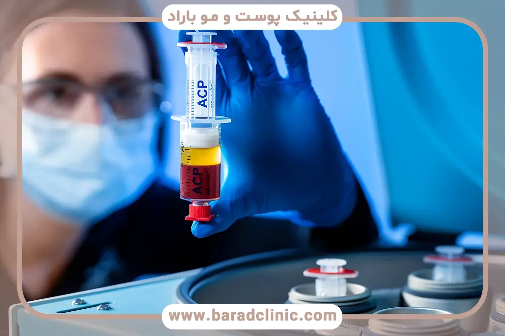 آیا prp موثر است؟ بررسی مزایا