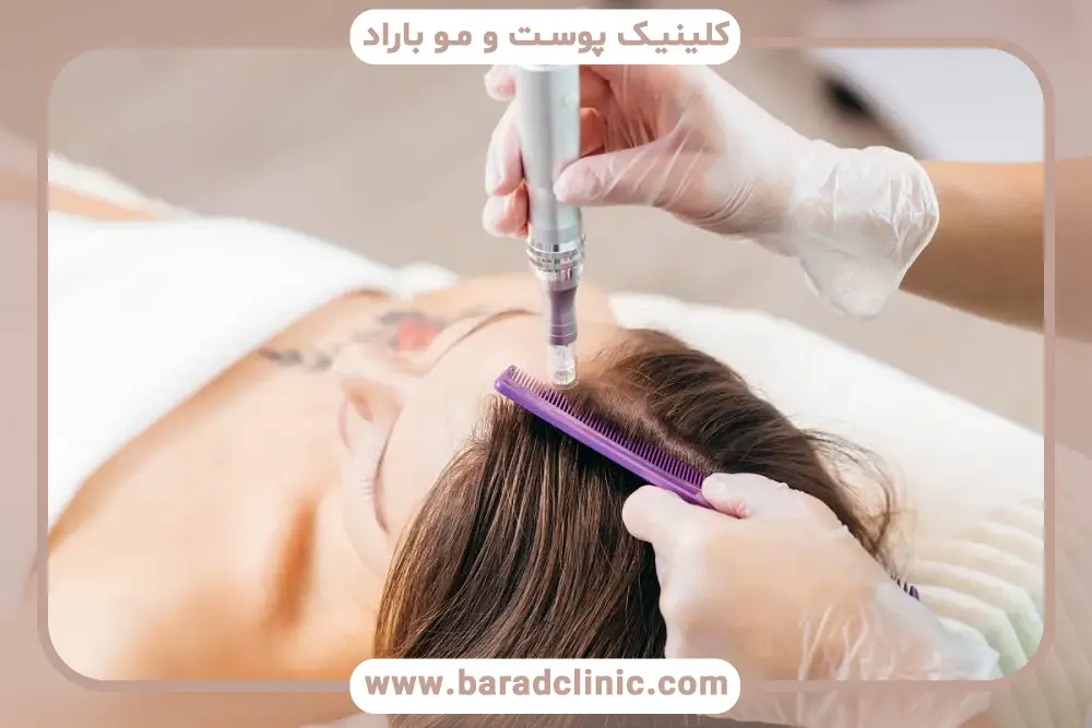 آیا prp درد دارد؟ میزان درد واقعی