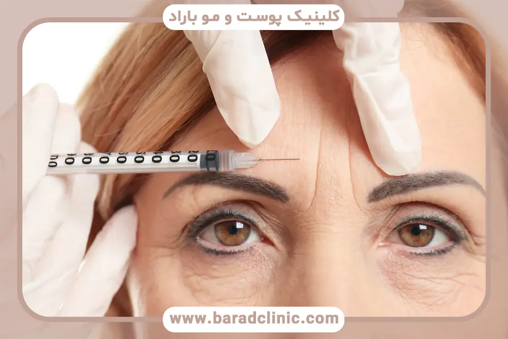 بوتاکس چیست؟