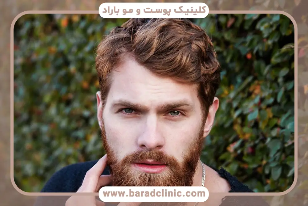 تکنیک‌های مدرن بهترین کاشت مو در ایران