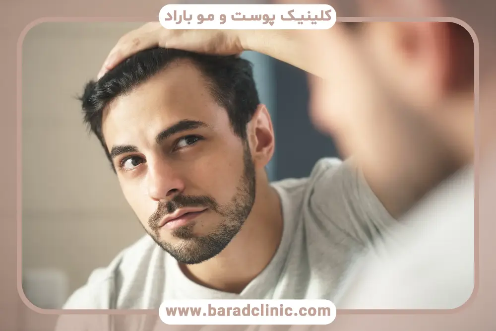 مزوتراپی برای ریزش هورمونی مو چیست؟ 