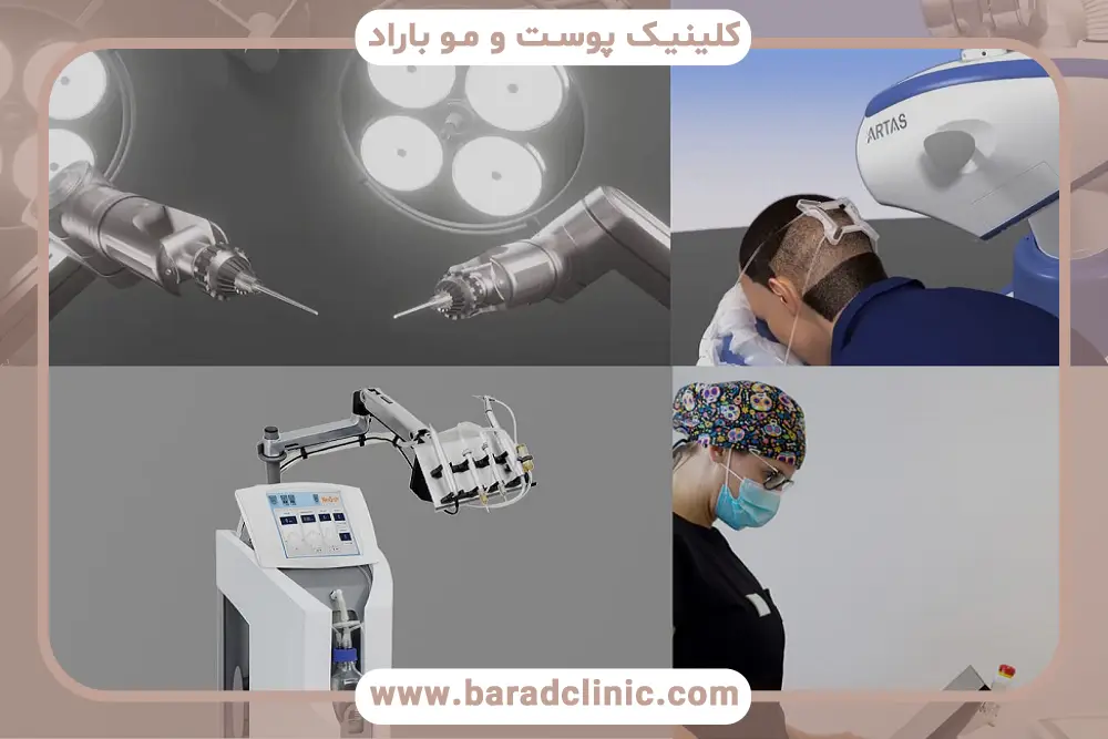 تفاوت کاشت مو با دستگاه تمام اتوماتیک و دستی