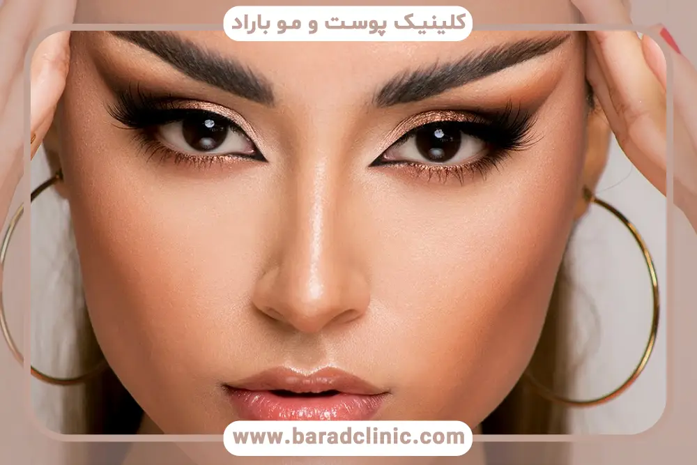 کاندیدای مناسب بلفاروپلاستی چشم روباهی