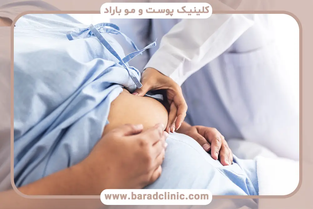 ویژگیهای کاندیدای مناسب بوتاکس معده چیست؟